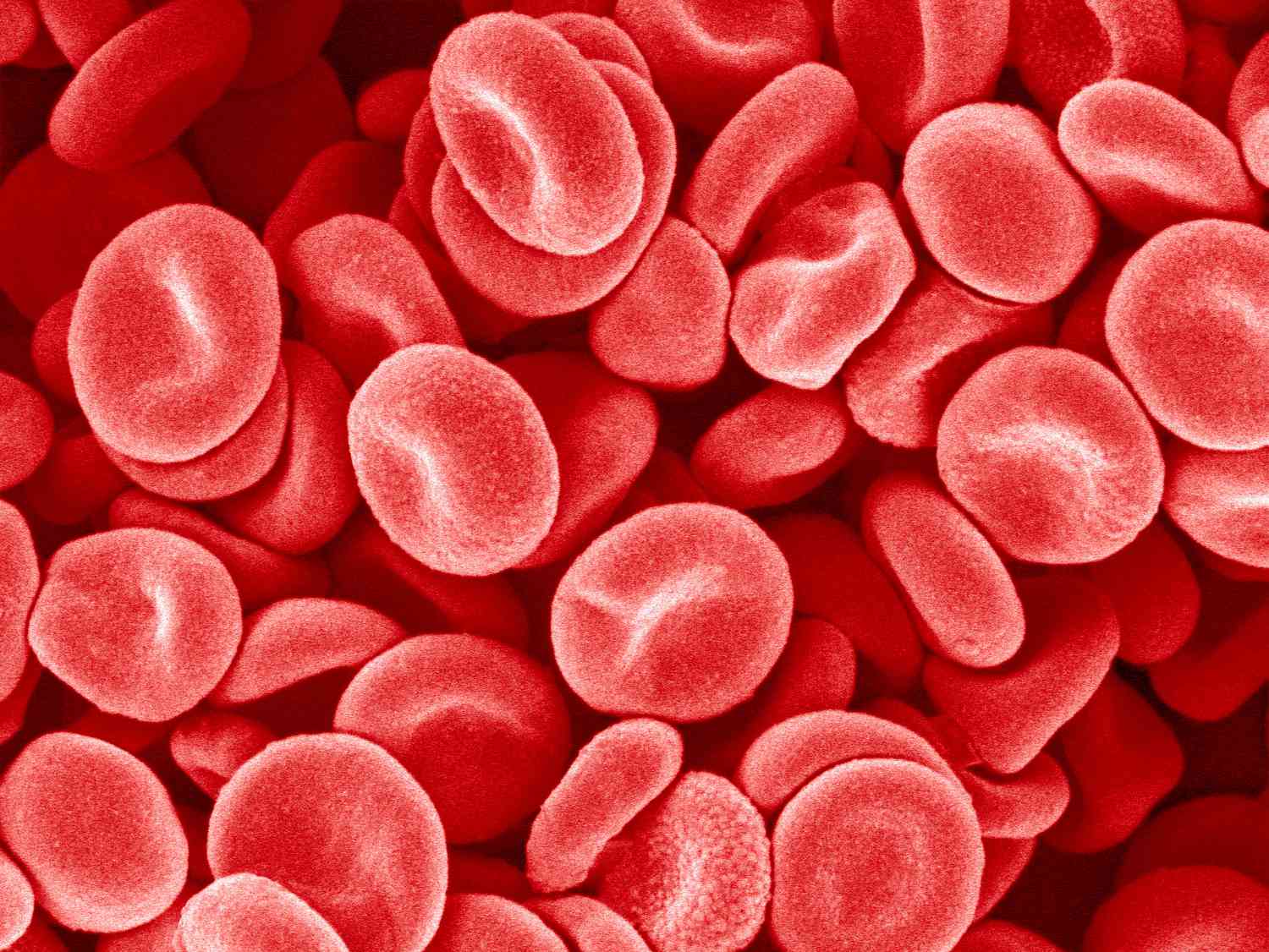 Expanding Options: FDA Approval of New Chronic Immune Thrombocytopenia Drug