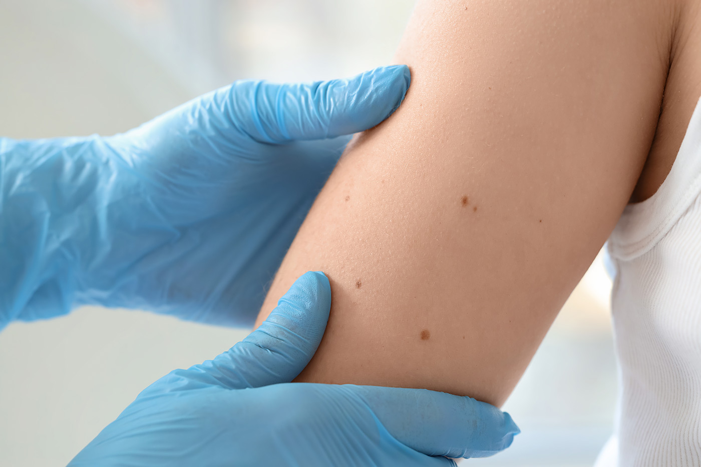FDA Expands Libtayo’s Role in Cancer Care with Adjuvant Approval for CSCC