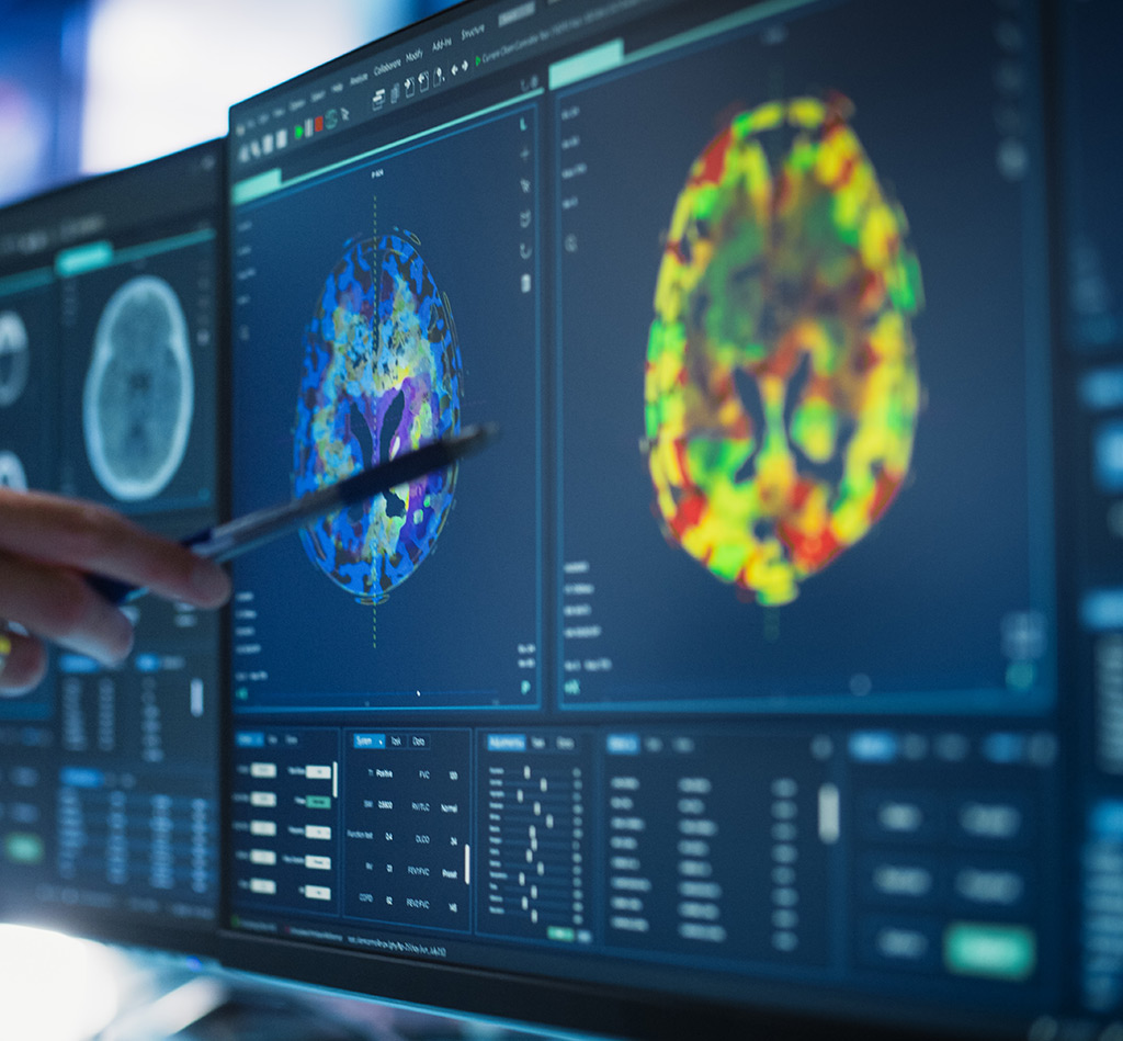 MHRA Joins Global Effort to Approve Promising Brain Cancer Treatment
