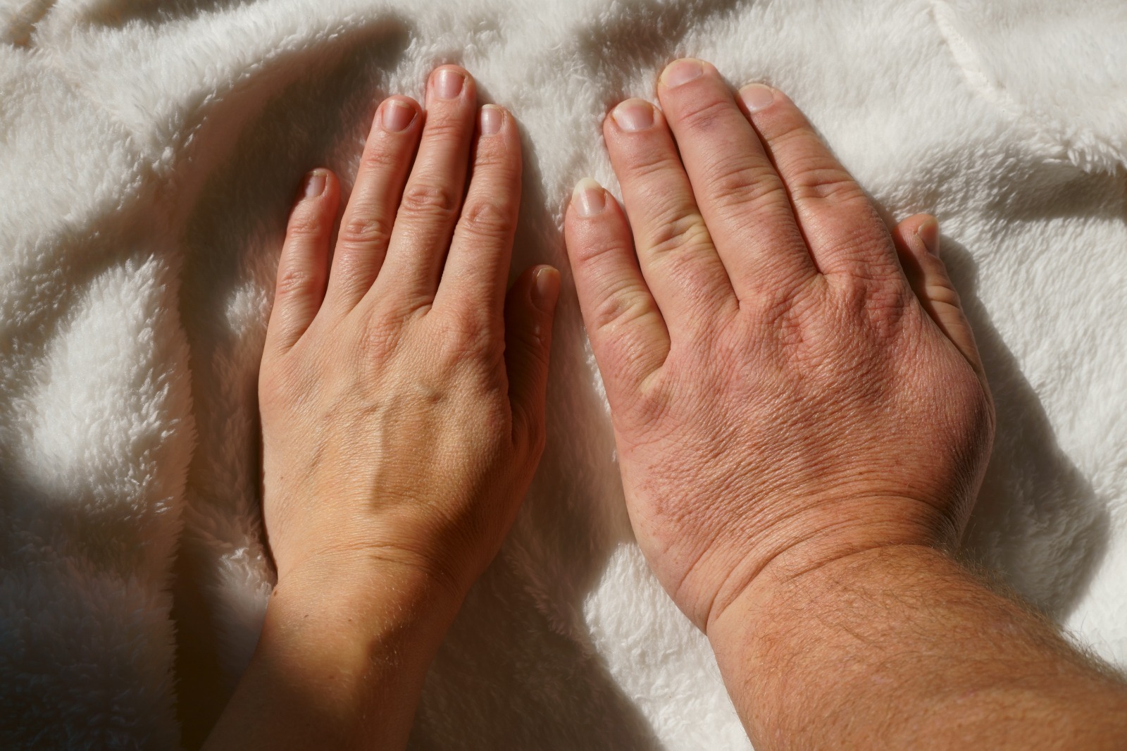 New Treatment Approval for Acromegaly Patients Spreading Hope