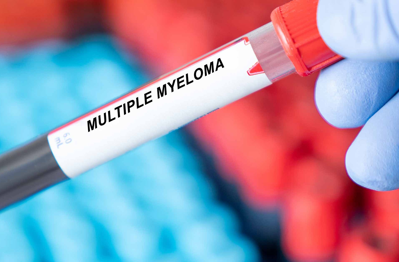 FDA Approves Belantamab Mafodotin-Blmf Combo for Refractory Multiple Myeloma
