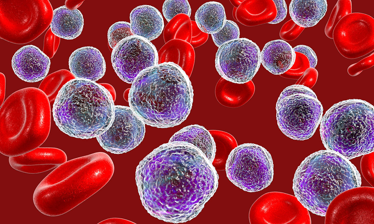 FDA Approves Revumenib: A New Hope for AML with NPM1 Mutation
